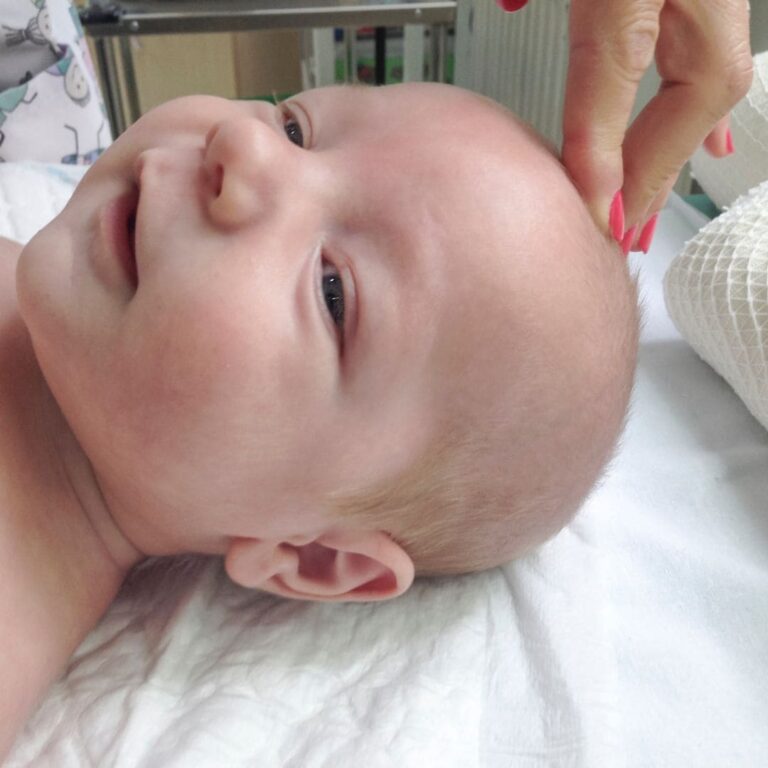 Lee más sobre el artículo ¿Qué son las fontanelas? Todo lo que debes saber desde la pediatría